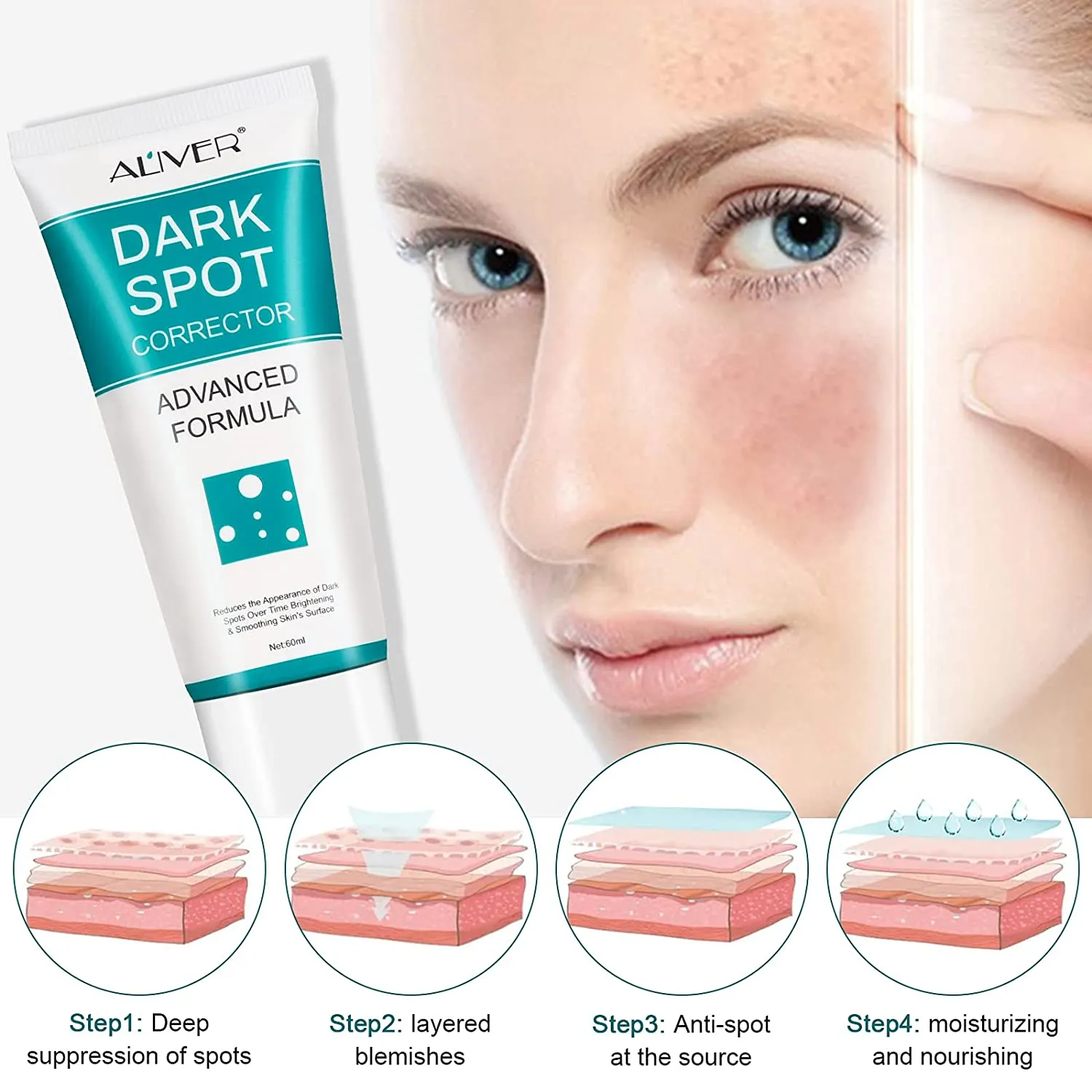 Aliver Dark Spot Corrector Cream-Age Spots Remover