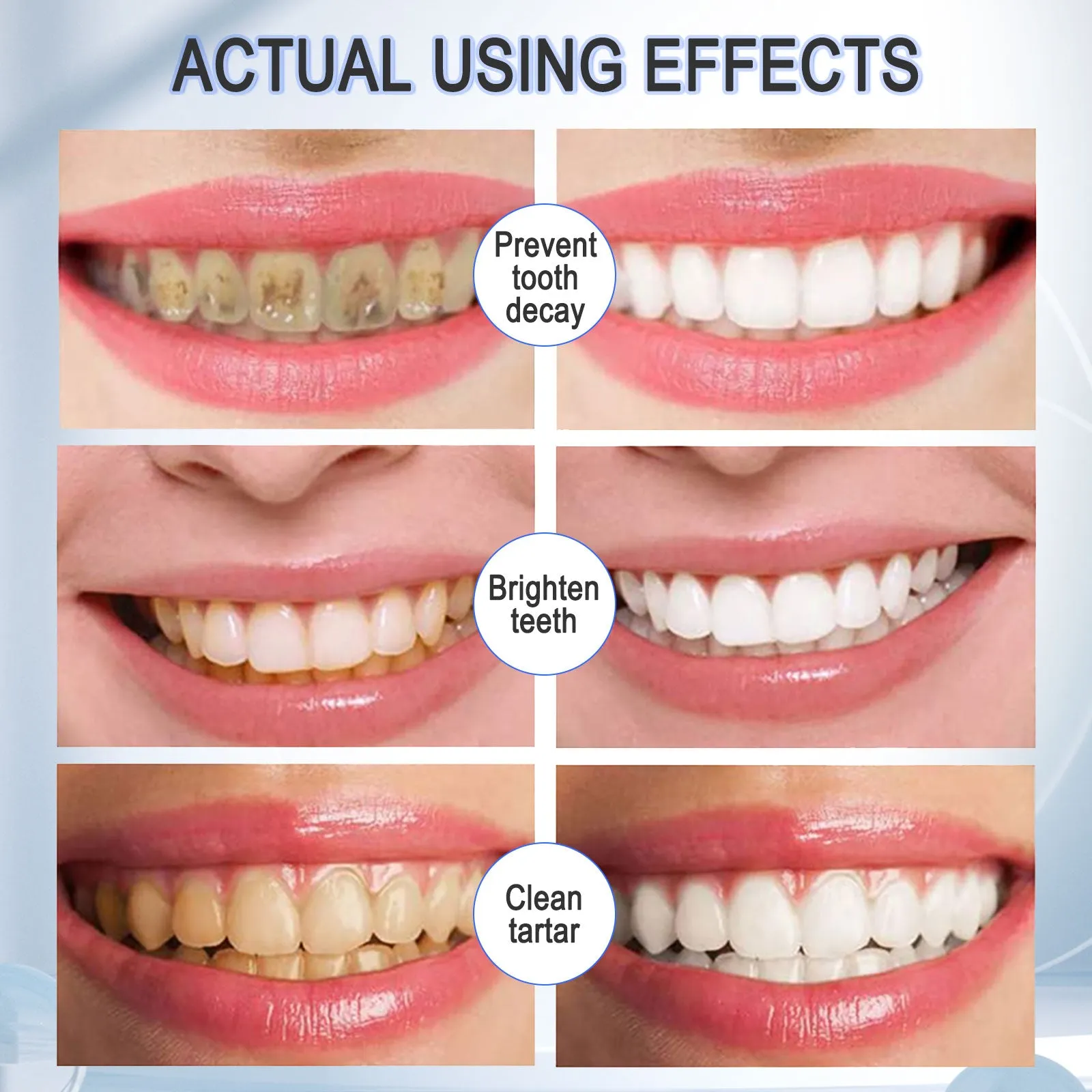 Aliver Teeth Whitening Toothpaste Foam, Fruit Flavor