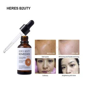 HERES B2UTY Remedies Vitamin C Serum