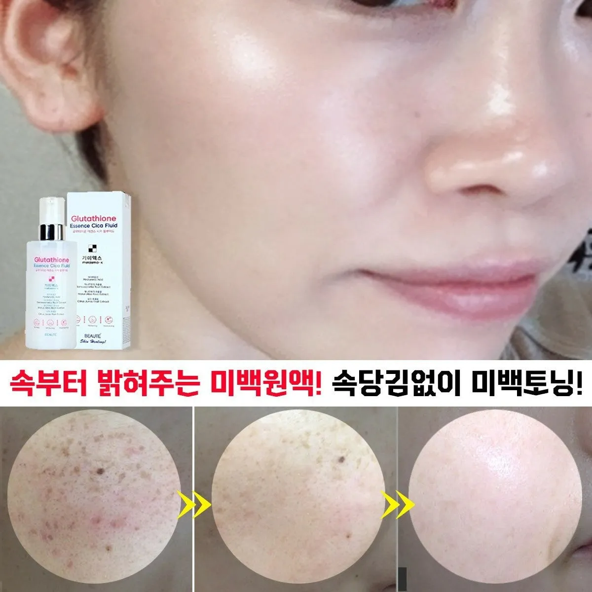 Made in Korea Glutathione Essence Cica Fluid melasma-x Skin soothing moisturizing essence that melts the freckles (1 1 1)(free shipping)