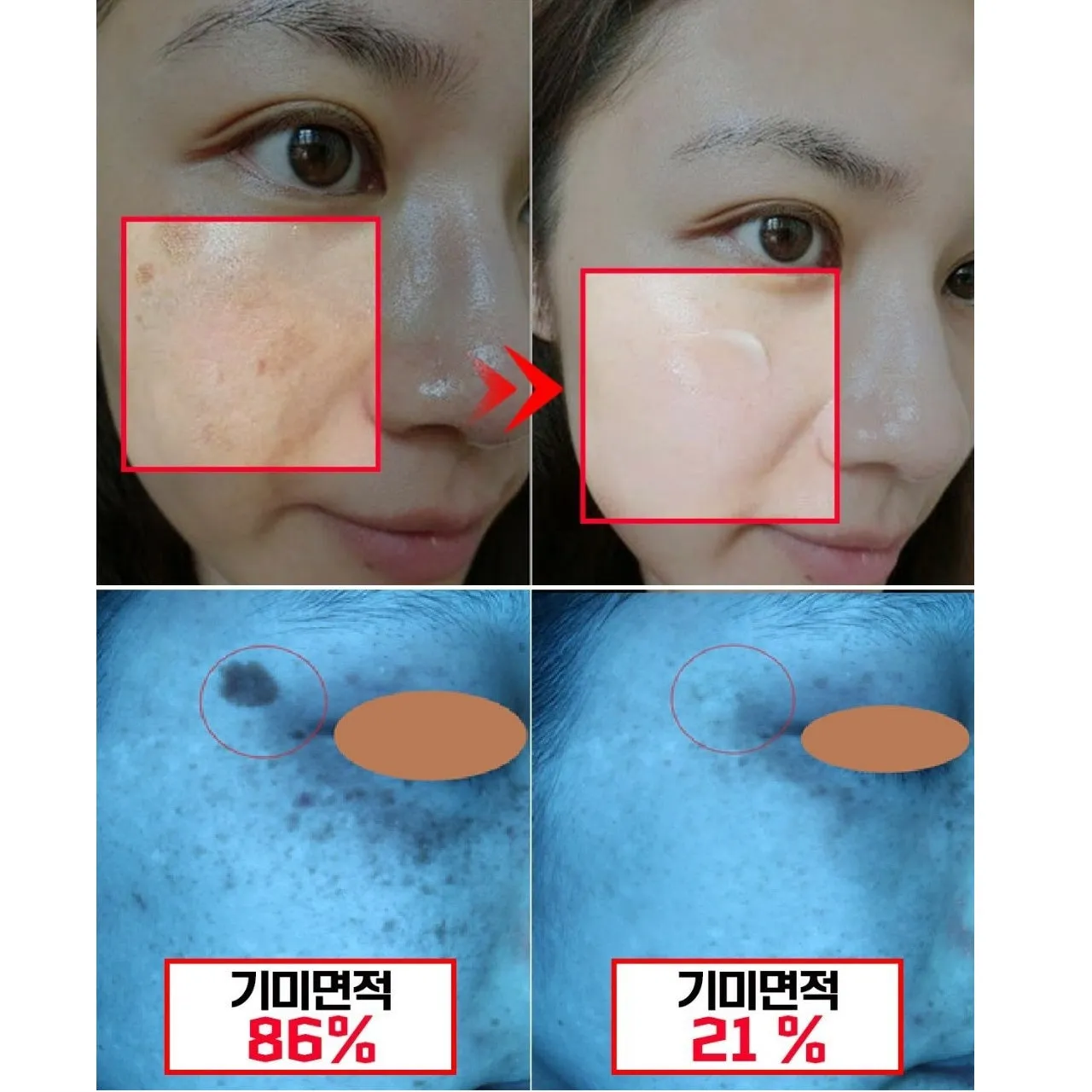 Made in Korea Glutathione Essence Cica Fluid melasma-x Skin soothing moisturizing essence that melts the freckles (1 1 1)(free shipping)